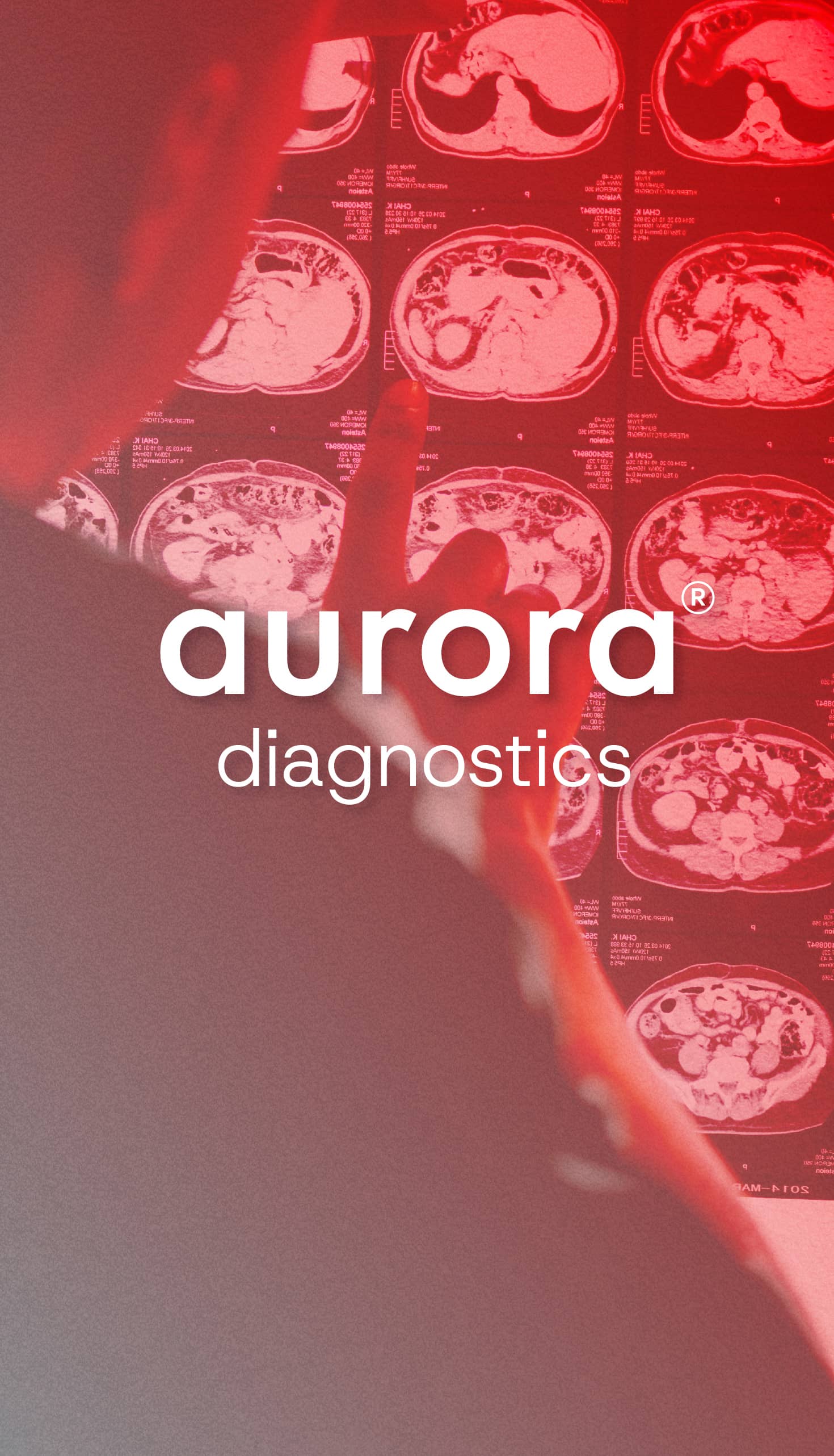 Aurora Diagnostics